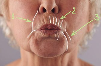 Как убрать глубокие морщины вокруг рта: 5 домашних масок, творящих чудеса с увядающей кожей. Изменения заметят все.