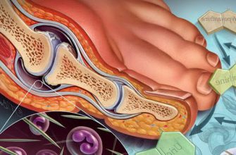 Продукт, который “подпитывает” подагру
