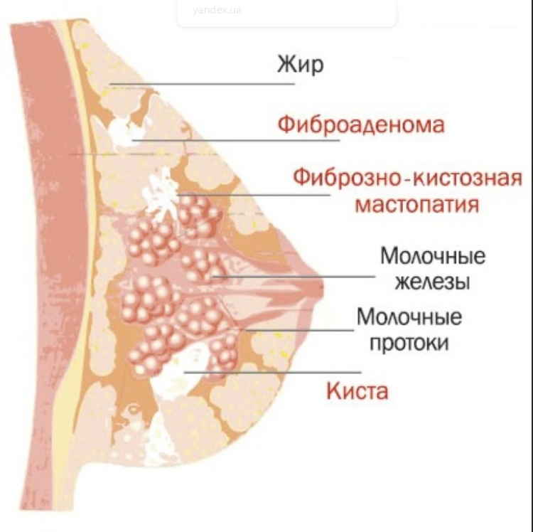 Мастопатия боится валерианы и зверобоя