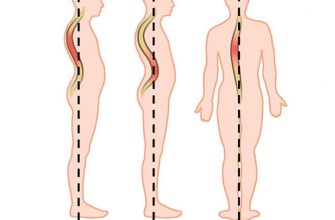 Восстановление осанки — возвращение здоровья. Почему от неправильной осанки страдает поджелудочная железа и выработка инсулина?