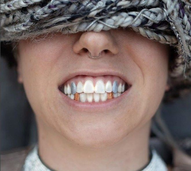 Макияж для зубов — новый бьюти-тренд, который не понравится дантистам