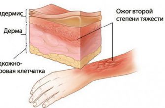 5 самых сильных из существующих видов боли