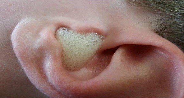 Эффективный способ чистки ушей