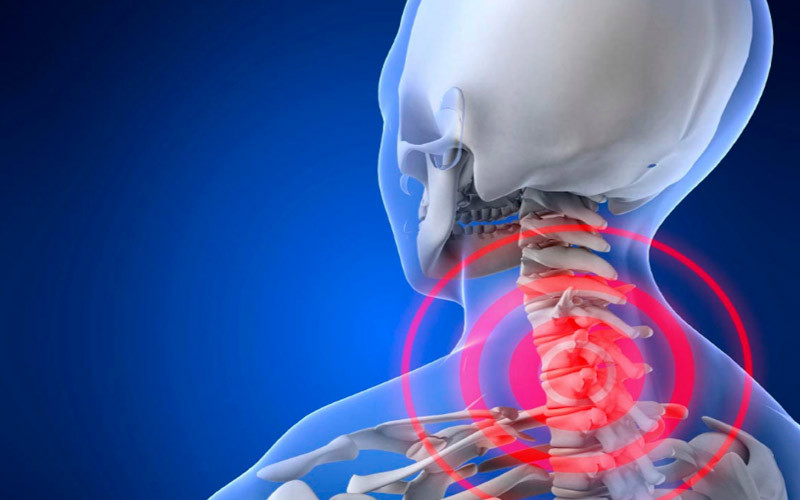 Больная шея – больная голова: упражнения для лечения заболеваний шейного отдела позвоночника