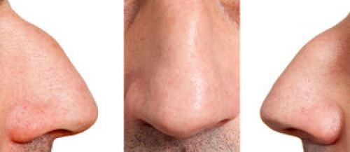 Вздернутый нос у женщин. Форма носа и характер человека