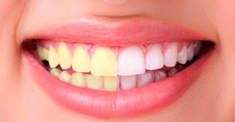 Белые и здоровые зубы: 8 хитростей дают 100% результат!