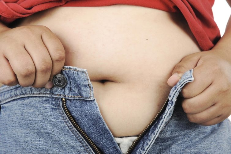 Печальные факты об ожирении