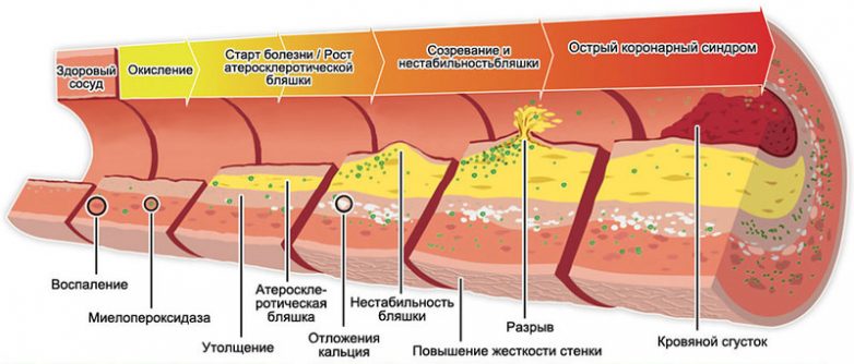 Важные факты о холестерине